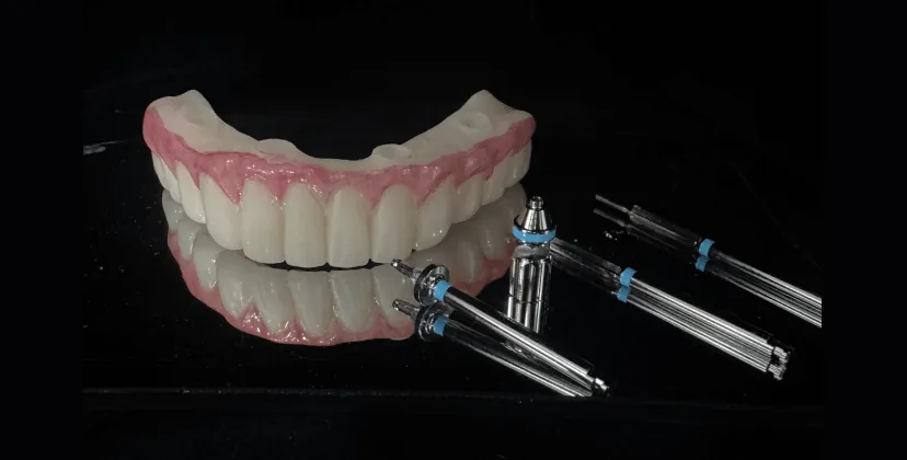 MUA 1차 보철 3D 프린팅 제작 사례 — 풀아치 임플란트 보철